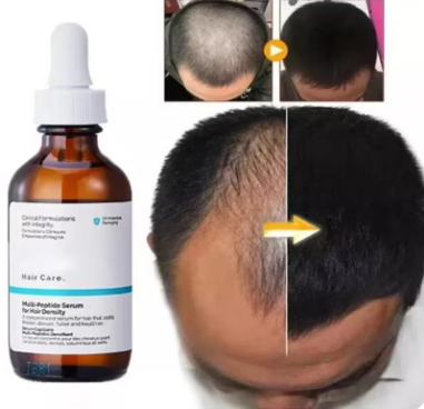 SUERO FORTALCEDOR Y ANTICAIDA - THE ORDINARY