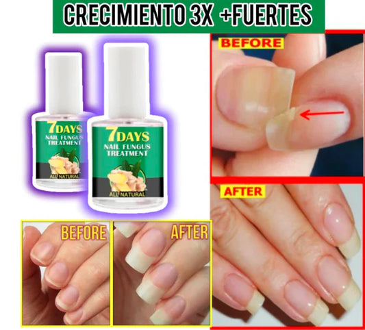 ENDURECEDOR DE UÑAS - PAGUE 1 LLEVE 3